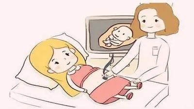 曾听到过胎心的钟晓芹没能保住宝宝 胎停育到底是什么拦路虎？
