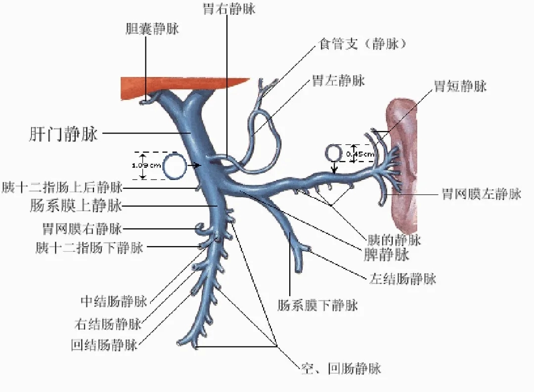 反复呕血、黑便怎么办？TIPS手术能解决