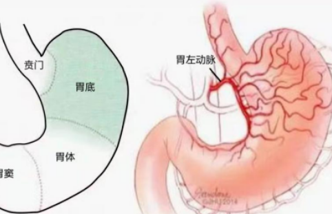 不开刀不吃药不饿肚子，微创介入减肥靠谱吗？