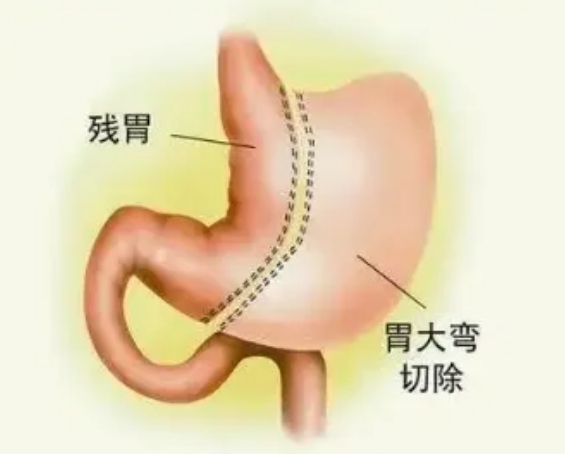 爱吃不想动，有救么？